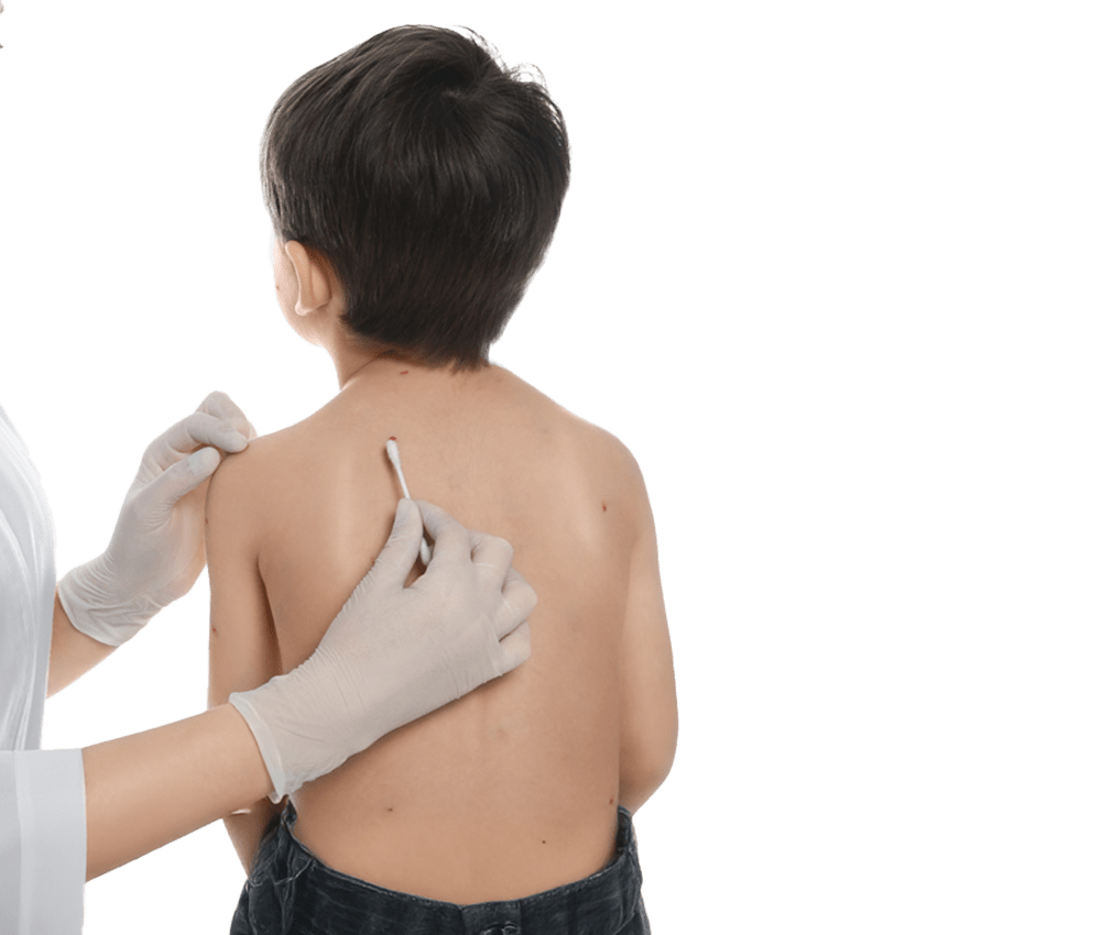 Dermatologia pediatrica