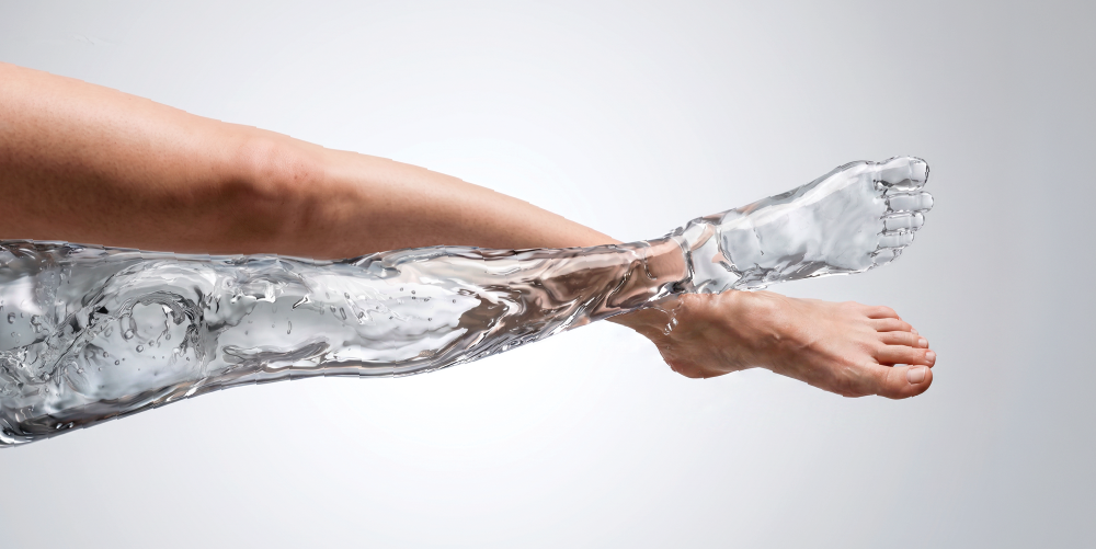 Lipedema o cellulite, scopri la differenza