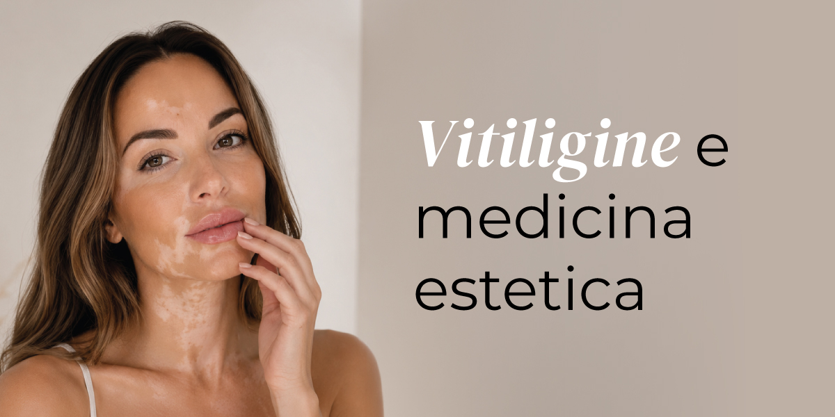 donna con vitiligine